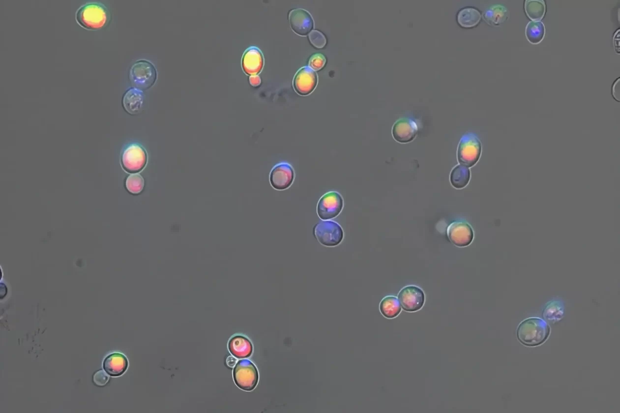 Urina para reparrar ossos