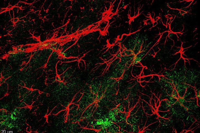 Envelhecimento cerebral